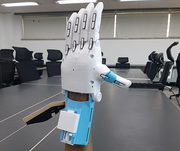 Prosthetic hand